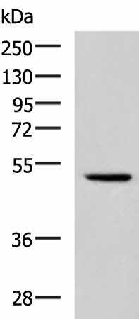 Western blot analysis of Hela cell lysate  using IRF2 Polyclonal Antibody at dilution of 1:900