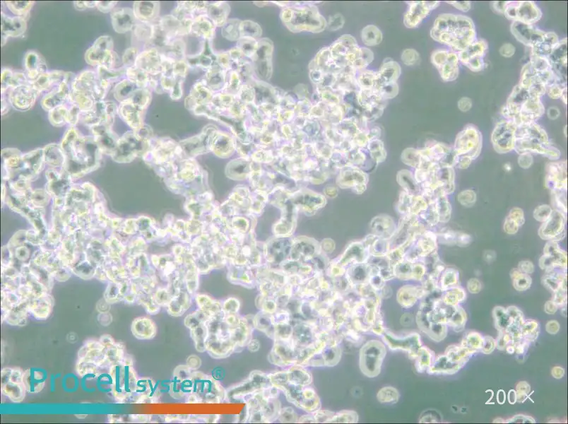 WERI-Rb-1 Cell Complete Medium - 6