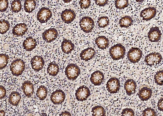 Recombinant Thioredoxin-2/TXN2 Monoclonal Antibody-searchlist-1