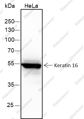 Recombinant Keratin 16 Monoclonal Antibody - 1