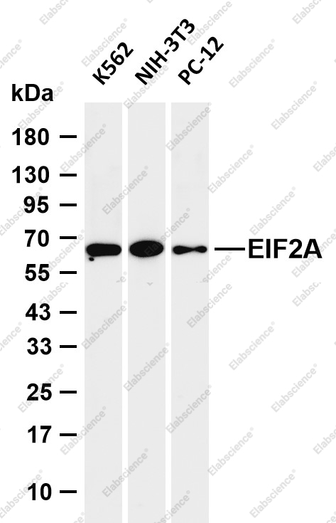 Recombinant EIF2S1 Monoclonal Antibody - 1