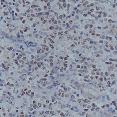 Recombinant Histone H3 (Acetyl Lys4) Monoclonal Antibody - 3