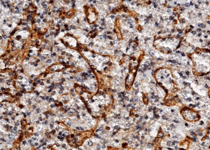 ICAM-2/CD102 Monoclonal Antibody-searchlist-1