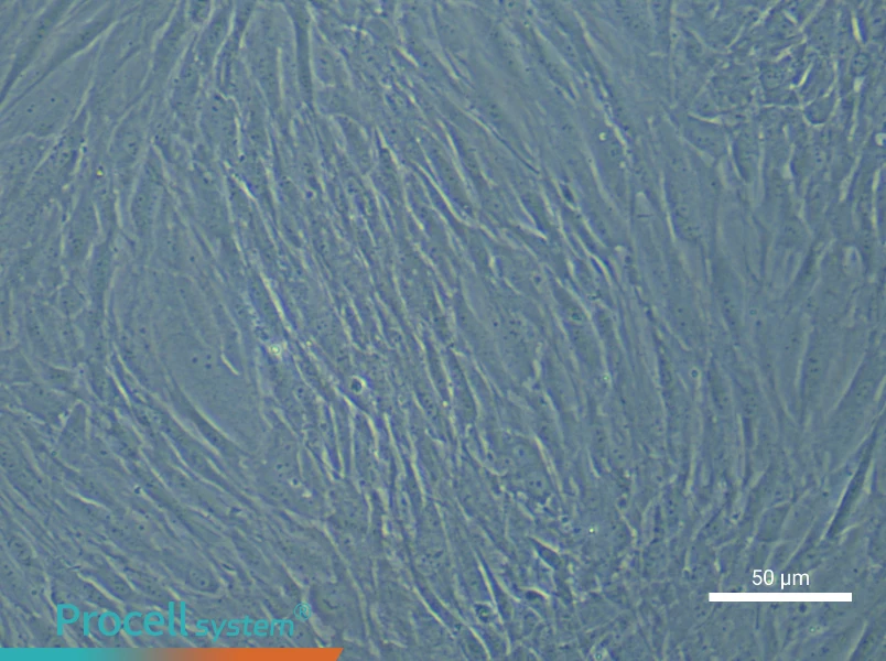 Human Bronchial Smooth Muscle Cell Complete Medium - 4
