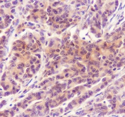 Recombinant TMS1/ASC Monoclonal Antibody - small - 3