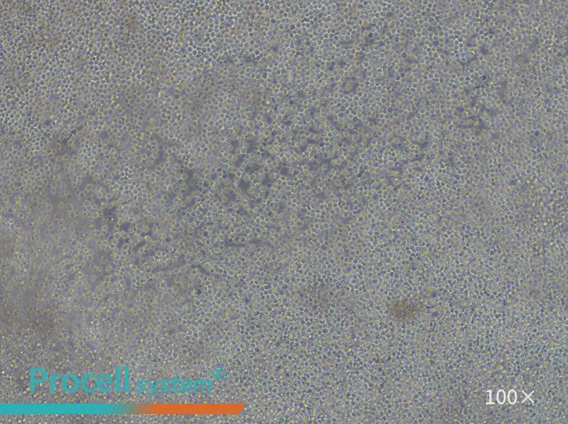 NFS-60 Cell Complete Medium - 2