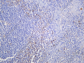 Recombinant CD33 Monoclonal Antibody - 1
