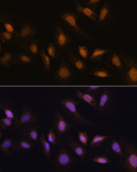 Immunofluorescence analysis of U-2 OS cells using RBM39 Polyclonal Antibody at dilution of  1:100. Blue: DAPI for nuclear staining.