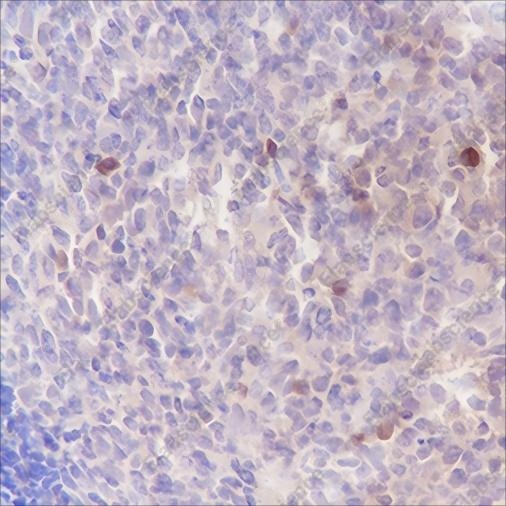 Recombinant ELP3 Monoclonal Antibody - 2
