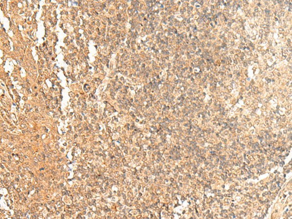 Immunohistochemistry of paraffin-embedded Human tonsil tissue  using GTF3A Polyclonal Antibody at dilution of 1:60(?200)