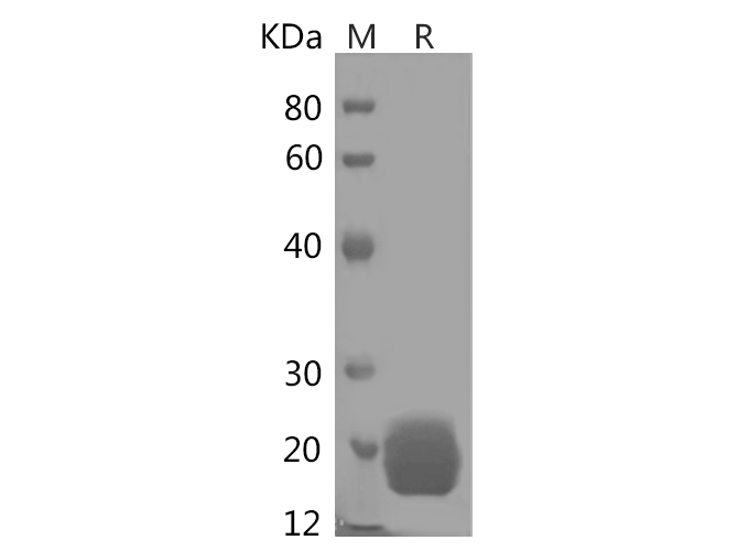 Recombinant Mouse CCL12 Protein(Trx Tag)-产品推荐-1