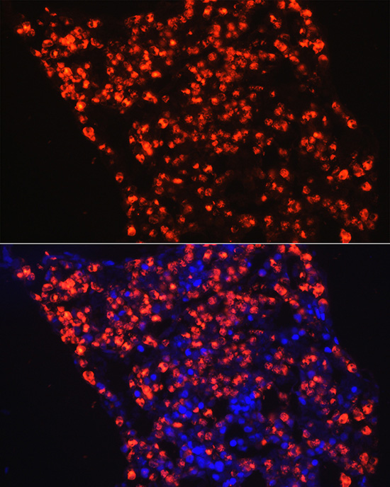 Immunofluorescence analysis of rat bone marrow cells using Myeloperoxidase (MPO) Polyclonal Antibody at dilution of 1:100 (40x lens). Blue: DAPI for nuclear staining.