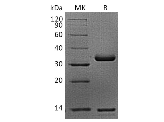 Recombinant Cynomolgus FcRn/FCGRT & B2M Heterodimer Protein (Flag & His Tag)