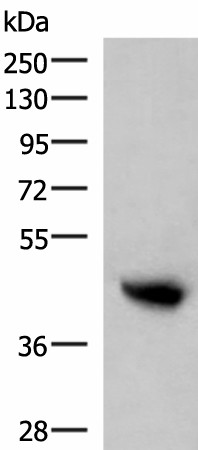 Western blot analysis of Human plasma solution  using KIR2DL5A Polyclonal Antibody at dilution of 1:800