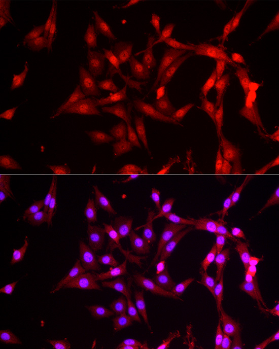 Immunofluorescence analysis of PC-12 cells using FBXW11 Polyclonal antibody at dilution of 1:200 (40x lens). Blue: DAPI for nuclear staining.