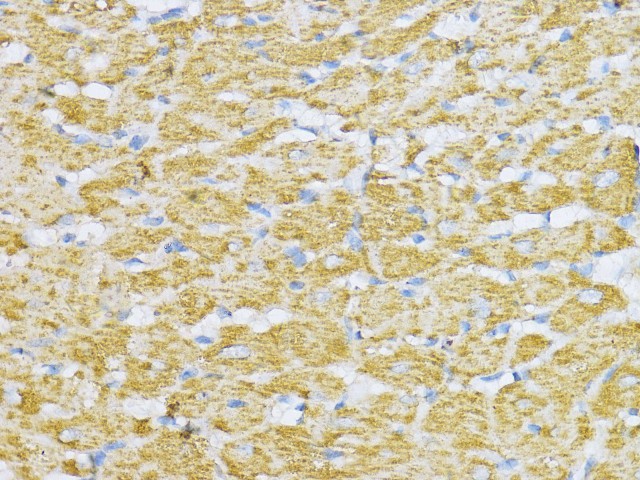 Immunohistochemistry of paraffin-embedded Rat heart using Aconitase 2 (ACO2) Polyclonal antibody at dilution of 1:100 (40x lens).Perform microwave antigen retrieval with 10 mM PBS buffer pH 7.2 before commencing with IHC staining protocol.