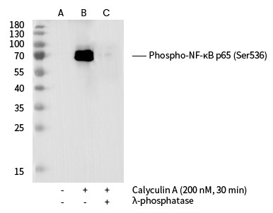 Recombinant Phospho-NF-κB p65 (Ser536) Monoclonal Antibody-searchlist-1