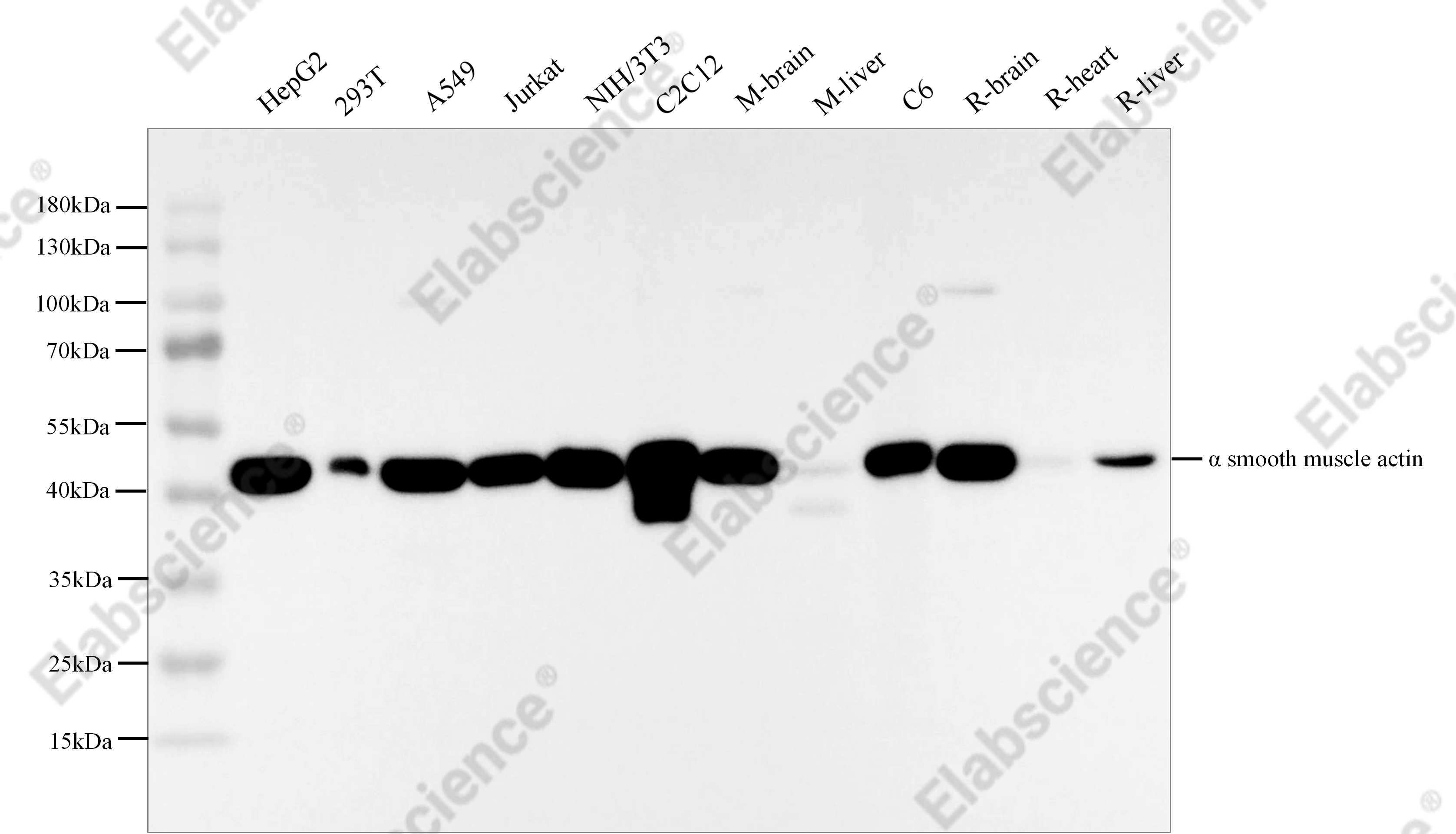 Recombinant α smooth muscle actin Monoclonal Antibody - 1