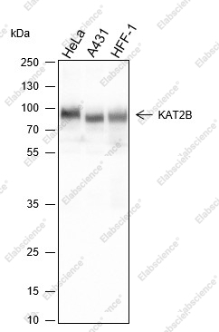 Recombinant PCAF Monoclonal Antibody - 1