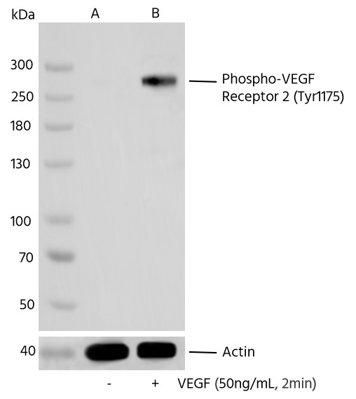Recombinant Phospho-VEGF Receptor 2 (Tyr1175) Monoclonal Antibody-searchlist-1