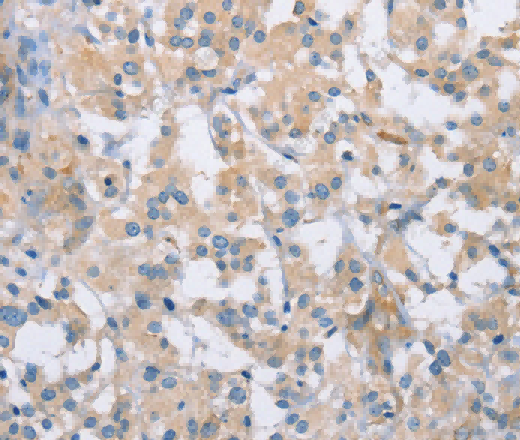 CDCP1 Polyclonal Antibody - 3