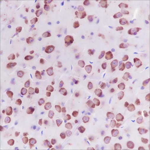 Recombinant LysRS Monoclonal Antibody - small - 3