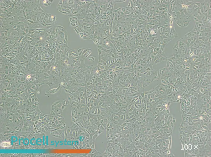 VERO C1008 [Vero E6] Cell Complete Medium - 3