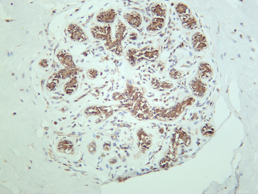 Recombinant GSK3β Monoclonal Antibody - 3