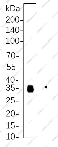 Recombinant Slug Monoclonal Antibody - 1