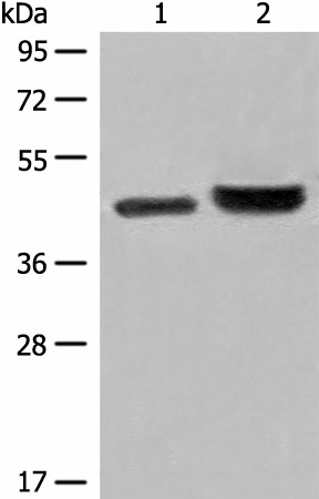 Western blot analysis of 231 cell and Human fetal liver tissue lysates  using INPP1 Polyclonal Antibody at dilution of 1:500