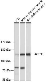 Western blot analysis of extracts of various cell lines using ACTN3 Polyclonal Antibody at 1:3000 dilution.