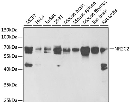 Western blot analysis of extracts of various cell lines using NR2C2 Polyclonal Antibody at 1:1000 dilution.