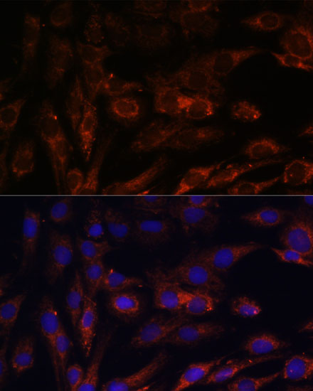 Immunofluorescence analysis of C6 cells using MRPS7 Polyclonal Antibody at dilution of 1:100. Blue: DAPI for nuclear staining.