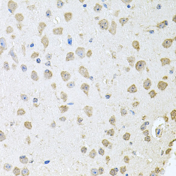 Immunohistochemistry of paraffin-embedded Mouse brain using TARS Polyclonal Antibody at dilution of 1:100 (40x lens).
