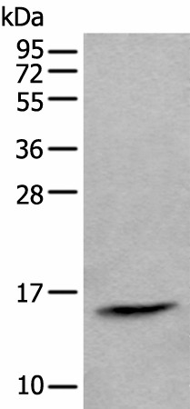 Western blot analysis of Human lymph gland tissue lysate  using CCL21 Polyclonal Antibody at dilution of 1:600