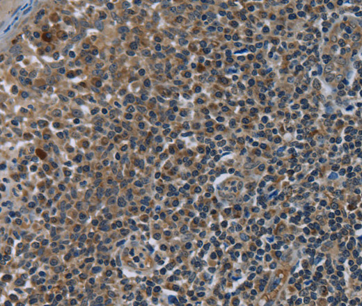 Immunohistochemistry of paraffin-embedded Human tonsil tissue using CD236 Polyclonal Antibody at dilution 1:60