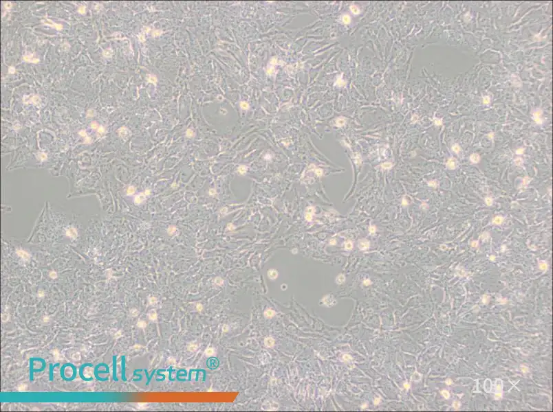 TTA1 Cell Complete Medium - 3