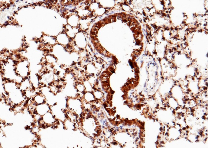 Recombinant SFTPD/SP-D/SFTP4 Monoclonal Antibody-searchlist-1
