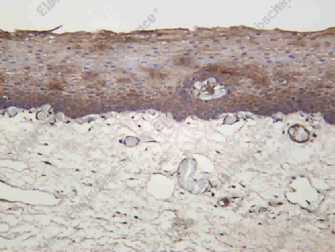 Recombinant EphB3 Monoclonal Antibody - 2