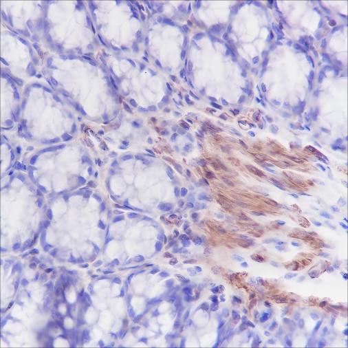 Recombinant Caldesmon/CDM Monoclonal Antibody - 2