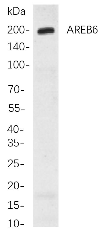 Recombinant AREB6 Monoclonal Antibody-searchlist-1