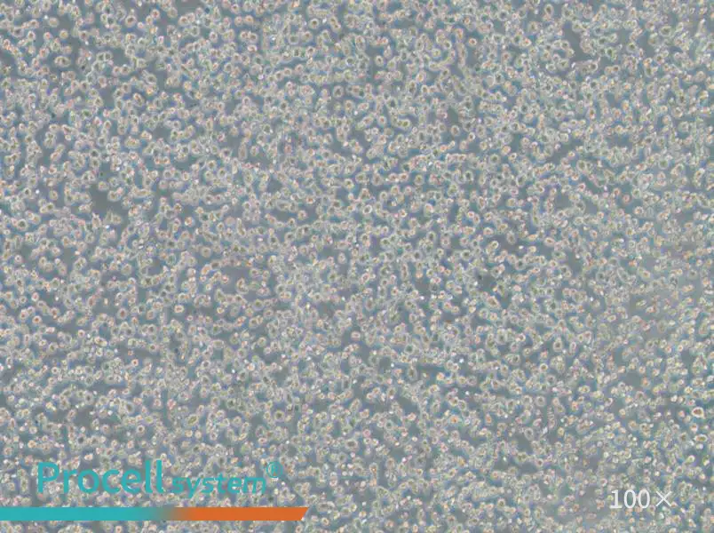 OPM2 Cell Complete Medium - 1