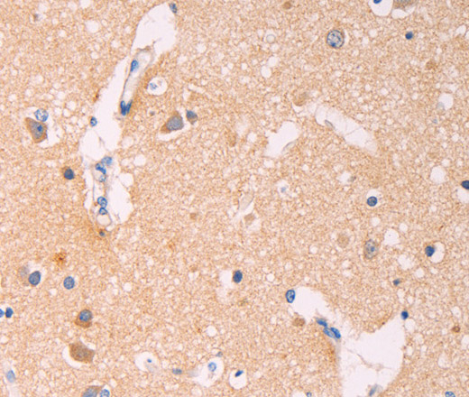 Immunohistochemistry of paraffin-embedded Human brain using ADCY1 Polyclonal Antibody at dilution of 1:60