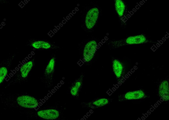 RPRD1B Monoclonal Antibody - 1