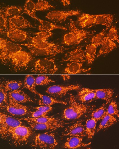 Immunofluorescence analysis of C6 cells using ACSL1 Polyclonal Antibody at dilution of 1:100 (40x lens). Blue: DAPI for nuclear staining.