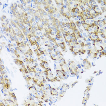 Immunohistochemistry of paraffin-embedded Mouse stomach using PIK3CA Polyclonal Antibody at dilution of 1:100 (40x lens).