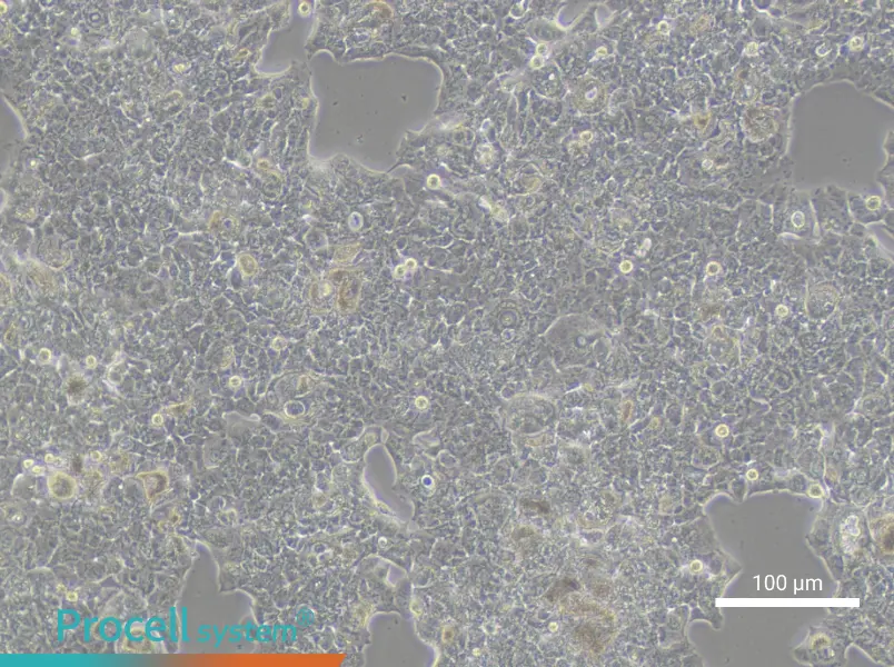 HCC1419 Cell Complete MediumHCC1419 Cell Complete Medium - 3
