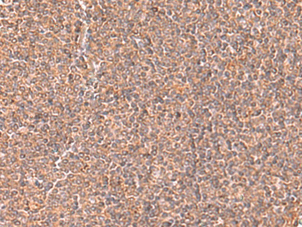 Immunohistochemistry of paraffin-embedded Human tonsil tissue  using RABEPK Polyclonal Antibody at dilution of 1:65(?200)