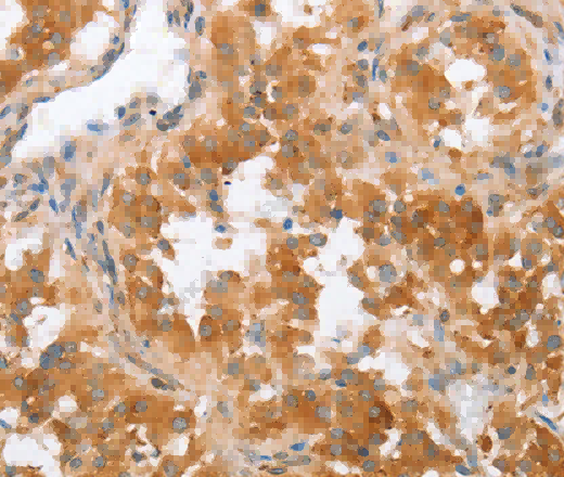 CRELD2 Polyclonal Antibody - 2