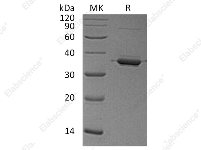 Recombinant Human Annexin A2/ANXA2 Protein - 1